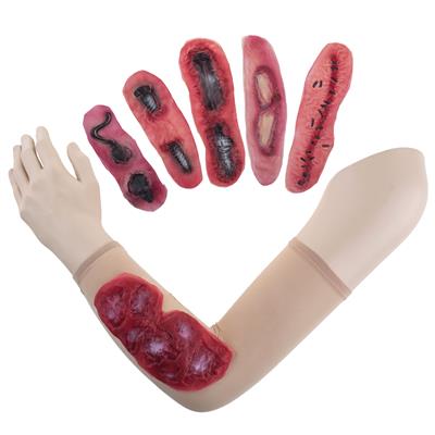 protesi in lattice ferite infette assortite