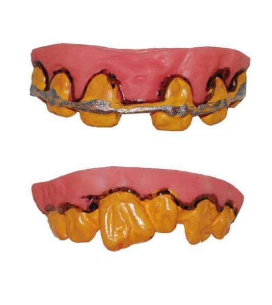 Denti da Zombie in Lattice