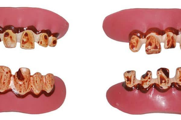 Denti da Zombie in Lattice